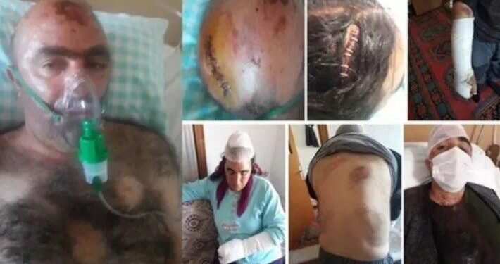 Konya’da Kürt aile faşist saldırıda katledildi: 7 kişi hayatını kaybetti